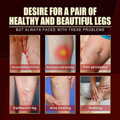 Vein Healing Varicose Veins Treatment Spray Pack of 2 - Premium  from Mystical9 - Just Rs 580 /- Shop now at Mystical9.com