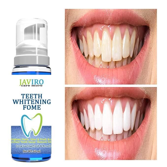 Teeth Whitening Fome (60 ML) - Premium  from Mystical9 - Just Rs 649 /- Shop now at Mystical9.com