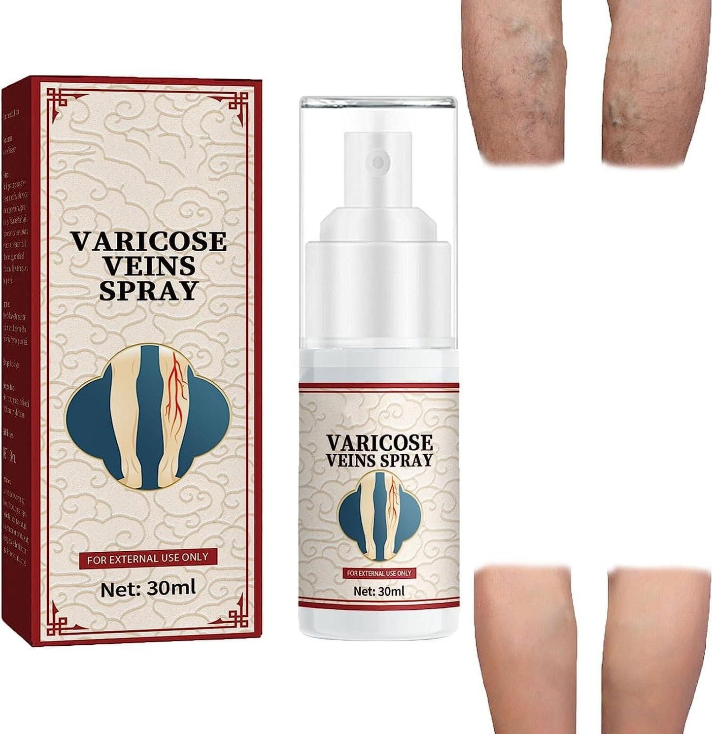 Vein Healing Varicose Veins Treatment Spray Pack of 2 - Premium  from Mystical9 - Just Rs 580 /- Shop now at Mystical9.com