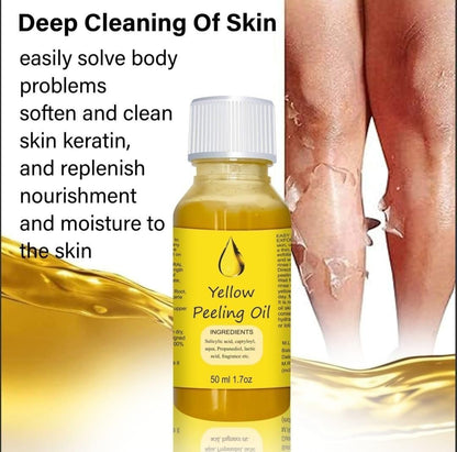 Peeling Oil for Dark Skin - 50 ml - Premium  from Mystical9 - Just Rs 499 /- Shop now at Mystical9.com