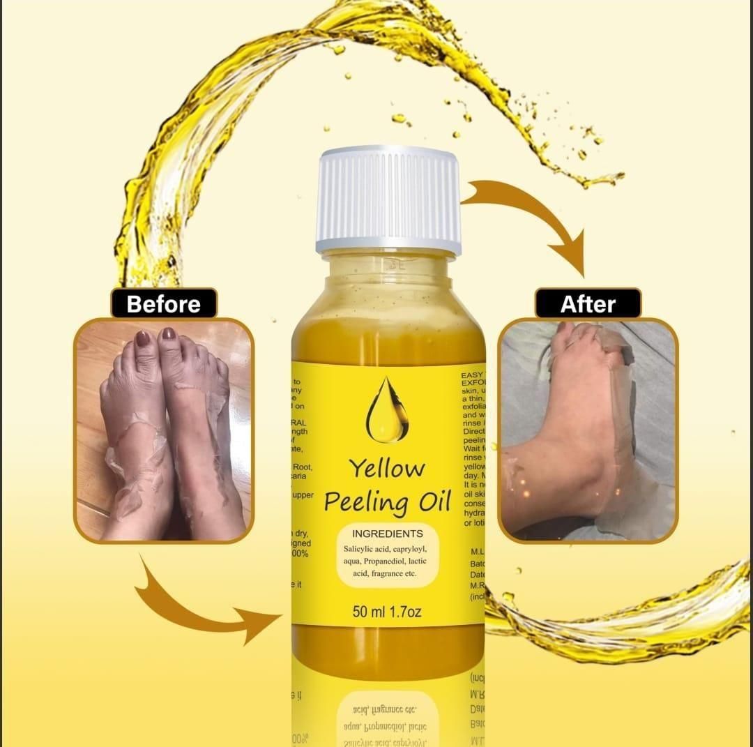 Peeling Oil for Dark Skin - 50 ml - Premium  from Mystical9 - Just Rs 499 /- Shop now at Mystical9.com