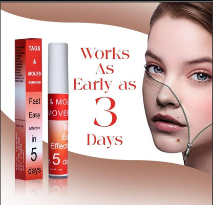 Tags & Moles Remover - Premium  from Mystical9 - Just Rs 600 /- Shop now at Mystical9.com