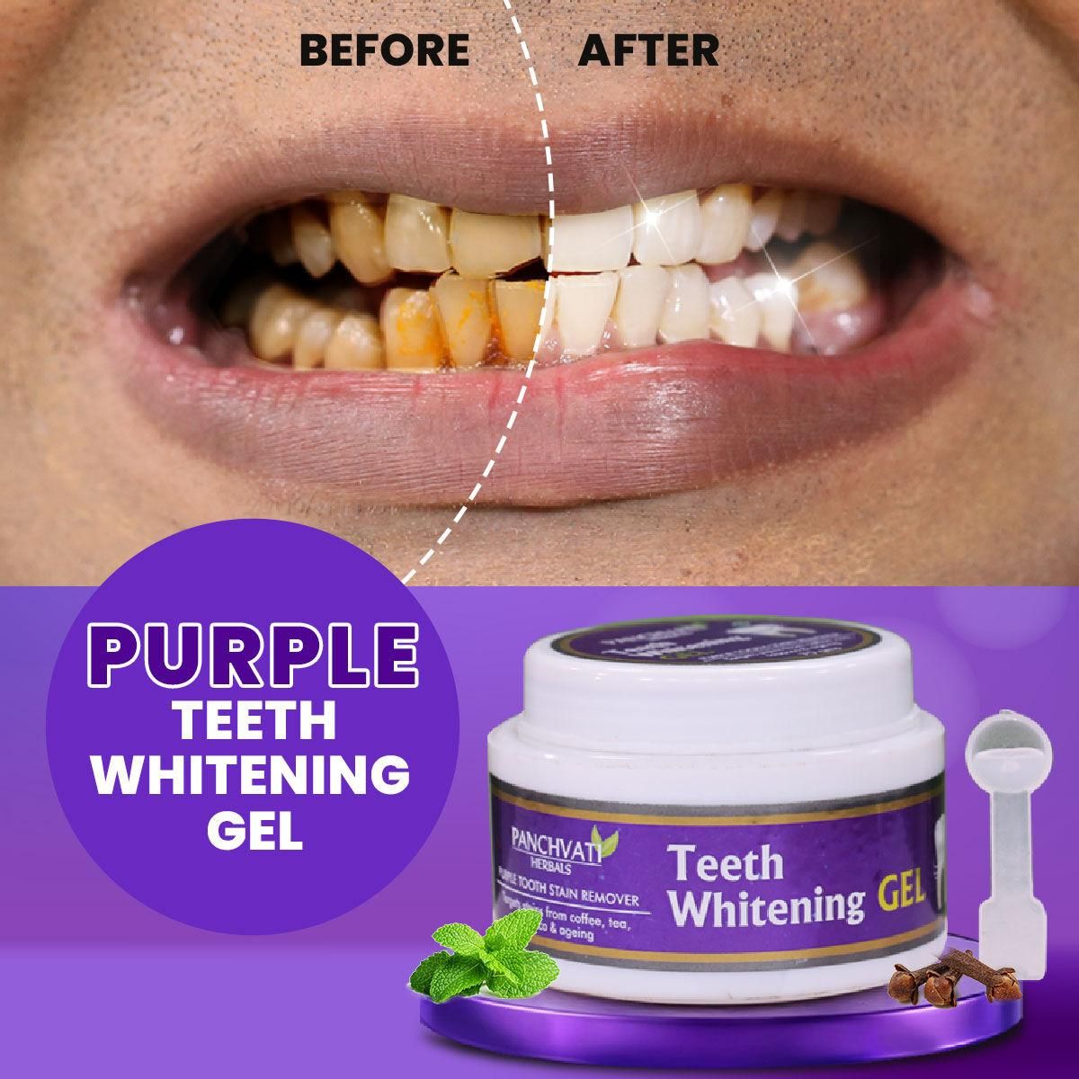 Purple Teeth Whitening Gel - Premium  from Mystical9 - Just Rs 599 /- Shop now at Mystical9.com