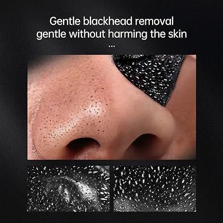 Blackhead Treatment Peeling Mask,50g - Premium  from Mystical9 - Just Rs 599 /- Shop now at Mystical9.com