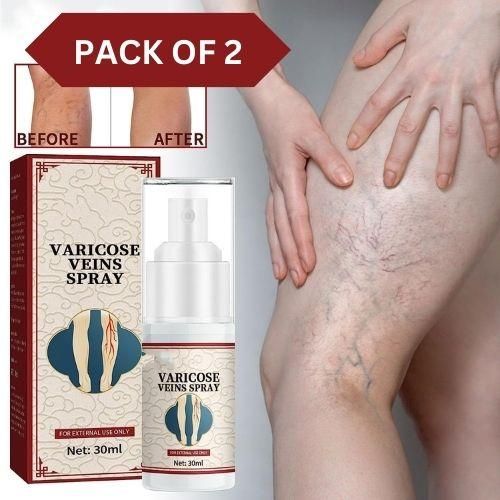 Vein Healing Varicose Veins Treatment Spray Pack of 2 - Premium  from Mystical9 - Just Rs 580 /- Shop now at Mystical9.com