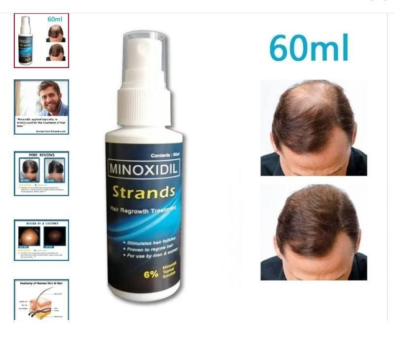 Minoxidil Topical Solution for Men 60ml - Premium  from Mystical9 - Just Rs 600 /- Shop now at Mystical9.com