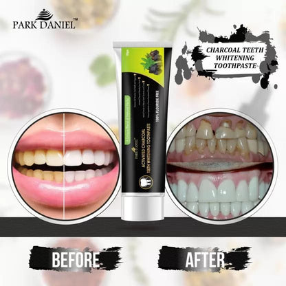 PARK DANIEL Natural Activated Charcoal Teeth Whitening Toothpaste - For Tobacco Stain, Tartar, Gutkha Stain and Yellow Teeth Removal | No Side Effect (100gm) Toothpaste  (100) - Premium  from Mystical9 - Just Rs 500 /- Shop now at Mystical9.com