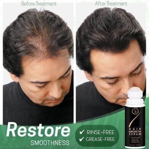 Hair Growth Serum 45ml (Multiple Packs) - Premium  from Mystical9 - Just Rs 500 /- Shop now at Mystical9.com