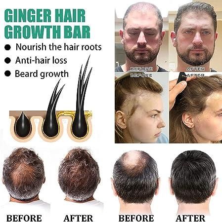 Ginger Hair Growth Bar (Pack of 1) - Premium  from Mystical9 - Just Rs 550 /- Shop now at Mystical9.com