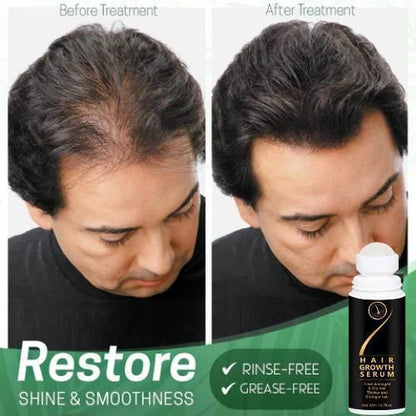 Hair Serum for Hair Growth - Premium  from Mystical9 - Just Rs 500 /- Shop now at Mystical9.com